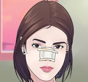 بهبود بعد از عمل بینی