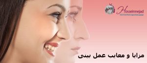 مزایا و معایب جراحی زیبایی بینی