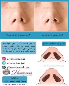 انواع جراحی بینی
