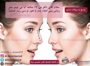 بهترین سن عمل بینی