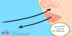آیا جراحی بینی صدای من را تغییر خواهد داد؟