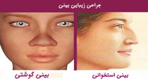 بینی استخوانی