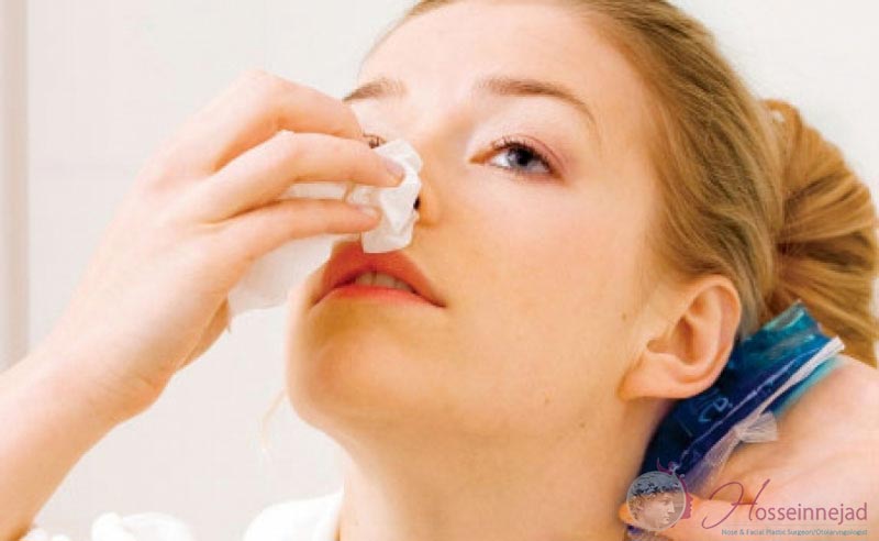 درمان شکستگی بینی