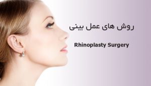 روش های عمل بینی