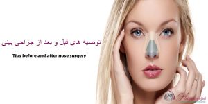 جراحی بینی