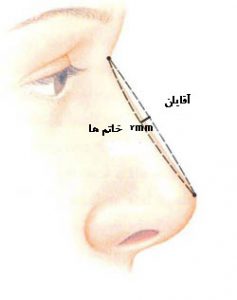پشت بینی زیبا
